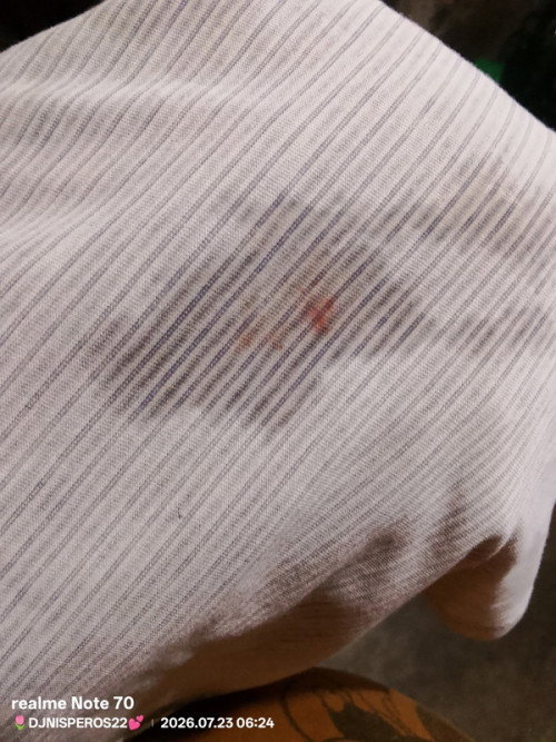 Bloody and mucus plug discharge !!??