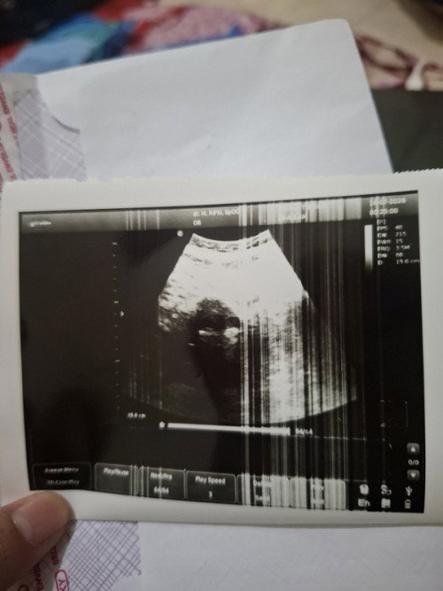 Bunda bunda pernah punya pengalaman seperti saya tidak?