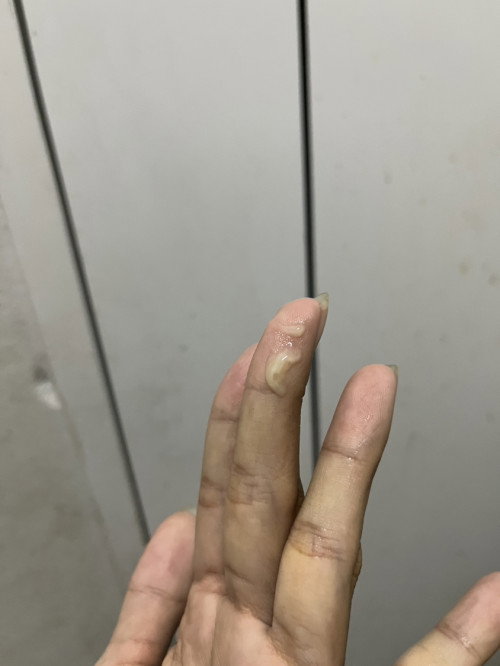 แบบนี้ใช่มูกไหมคะหรือตกขาว