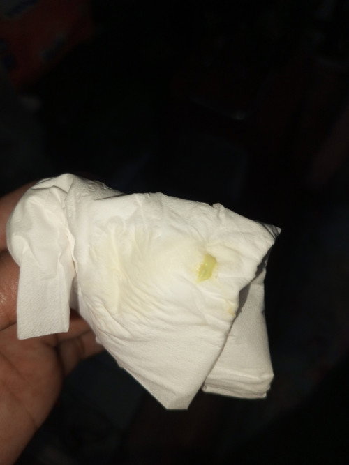Keputihan kehijauan