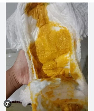 Pup bayi normal atau tidak