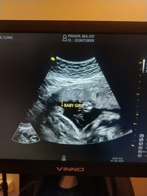 6 months preggy❤️
