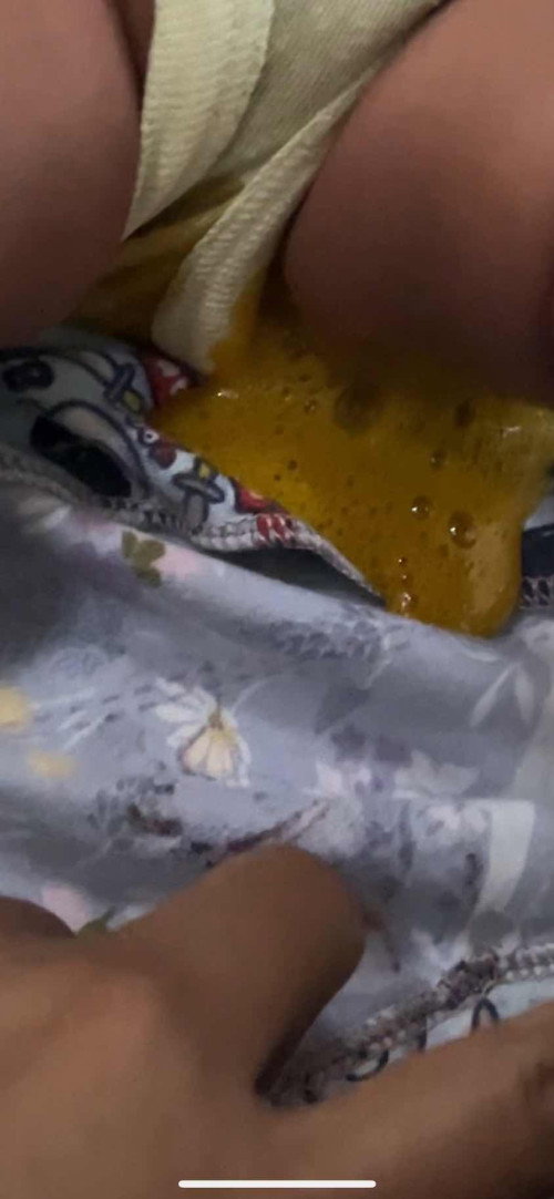 Pup bayi 1 bulan 5 hari