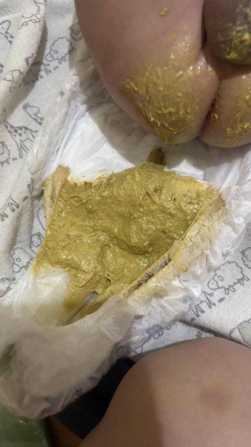 susu formula