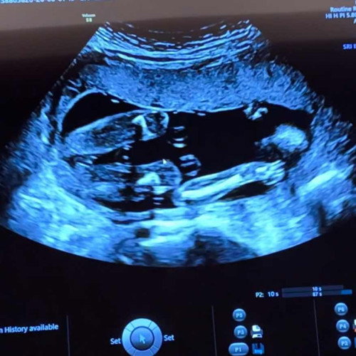Boy or girl?