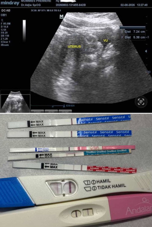 positif tapi belom ada kantong?