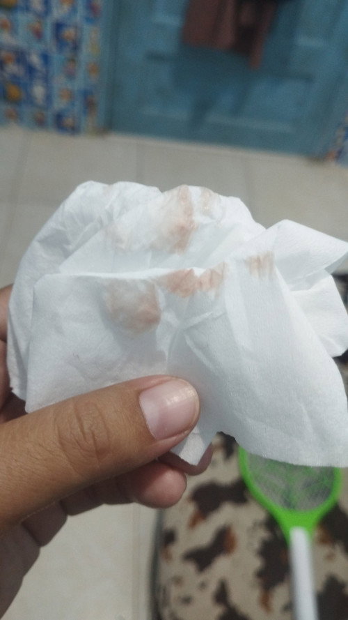 Positif bakteri. ISK