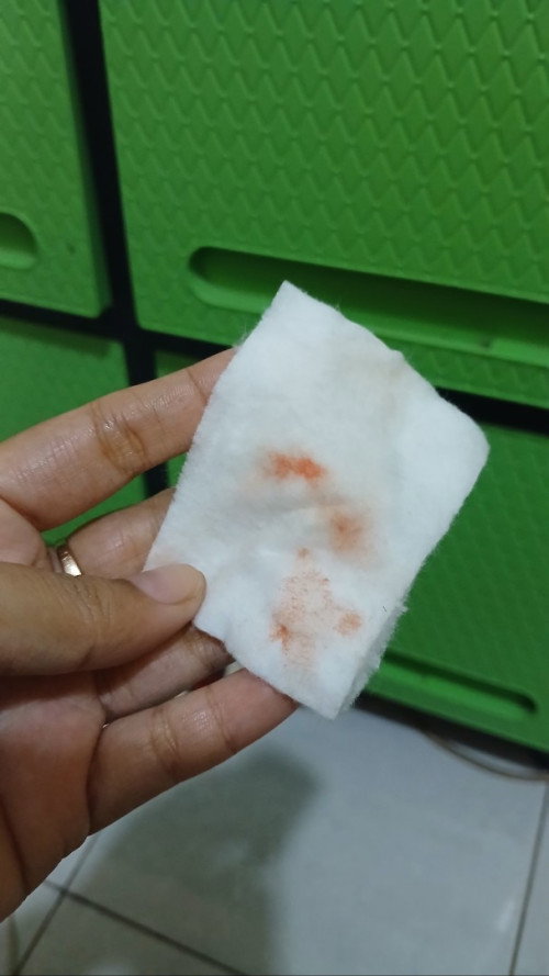 Bun, ada yg sama engga hamil 7 minggu keluar flek kaya gini normal ga ya?🙏🏻