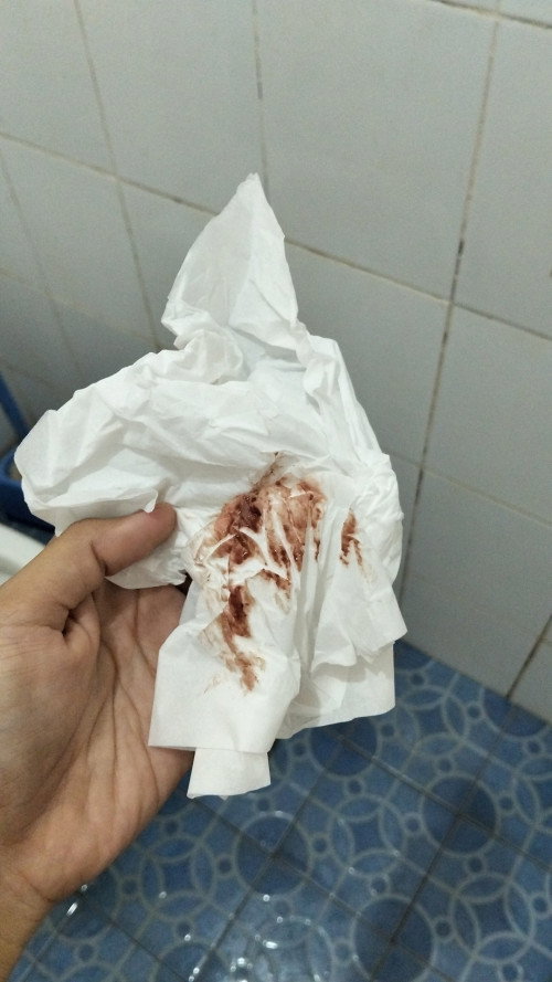 Usia kandungan 6 Minggu