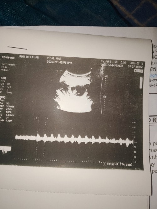 9weeks and 1day pregnancy
