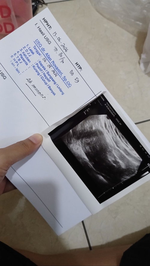 Bun ada yg sama ga hasil usg usia 7 minggu belum keliatan kantong sama janinnya?🥺