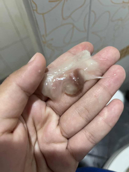 38+5 มีหมูหออกแบบนี้ควรไปหาหมอไหมค่ะ