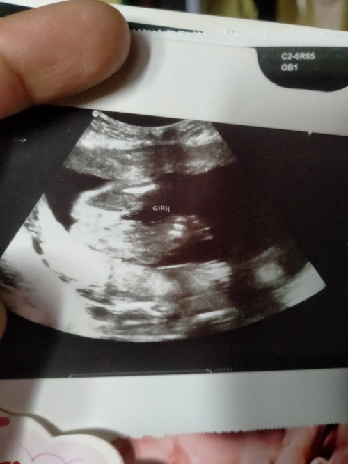 Gender baby 22 weeks