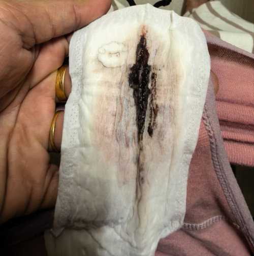 Semalam spotting coklat, harini bercampur tapi i tak rasa sakit