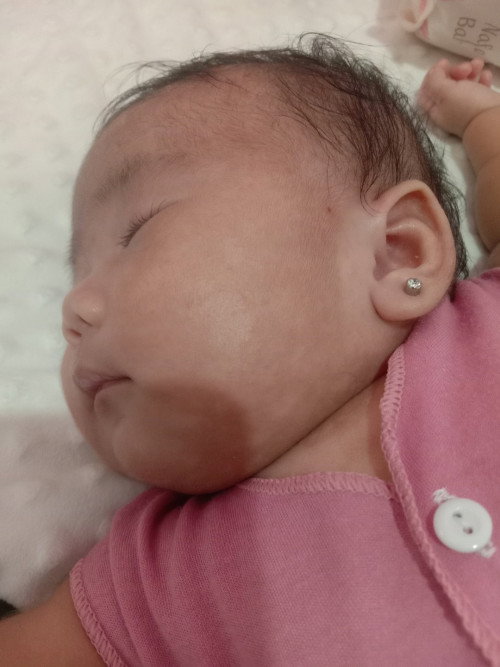 Warna kulit bayi tidak merata/belang