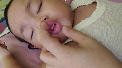 Bayi 10 bulan gtm