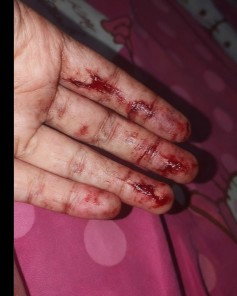 Keluar flek