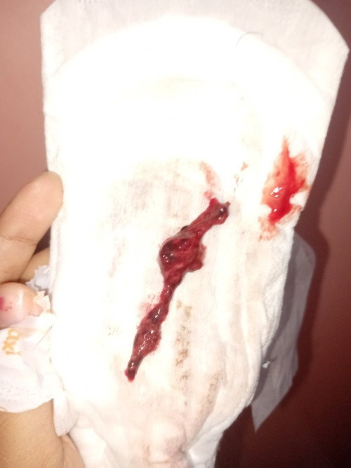 Bun ada yg tau ini gumpalan darah haid atau keguguran? Soalnya telat 2mingguan pas usg kosong