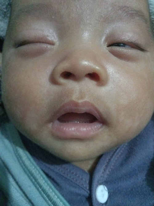 bercak putih di wajah