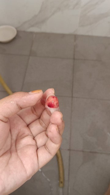Sy 36 week 4 hari tapi dia ada Kuar lendir dgn darah sikit