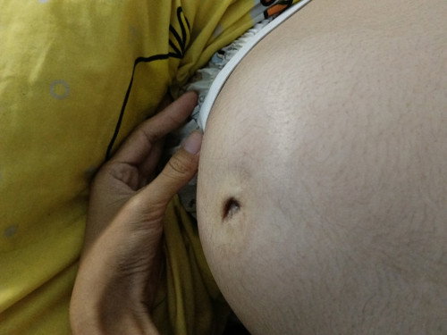 การปวดท้อง