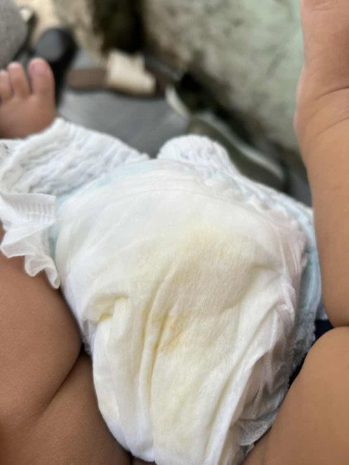 Pipis sedikit sudah 1 bulan