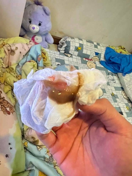 มีมูกเลือดแบบนี้ต้องไปโรงพยาบาลไหมค่ะ