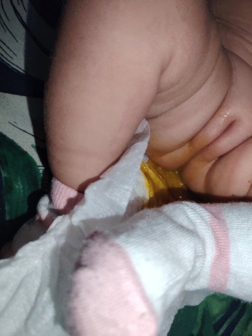 Poop ni baby