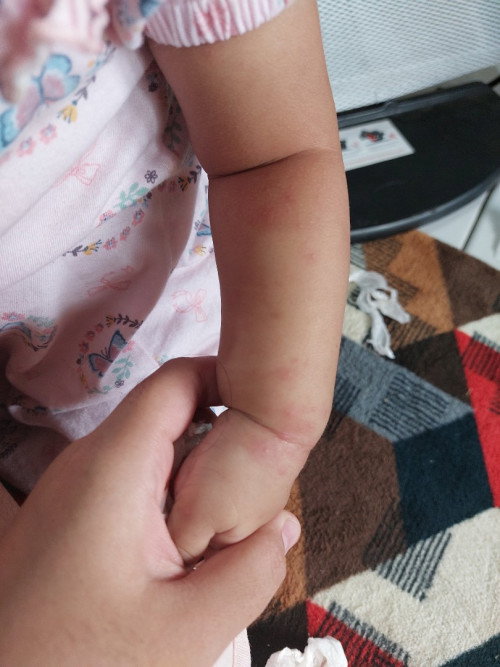 Bayi 10 bulan