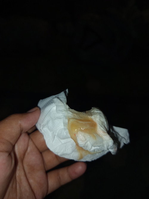 maaf sebelum nya kalo jiji 🙏