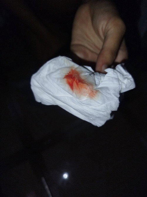 Tanya seputar persalinan