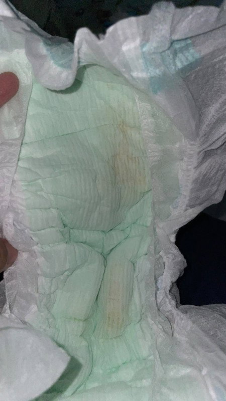 urin seperti ini normalkah?