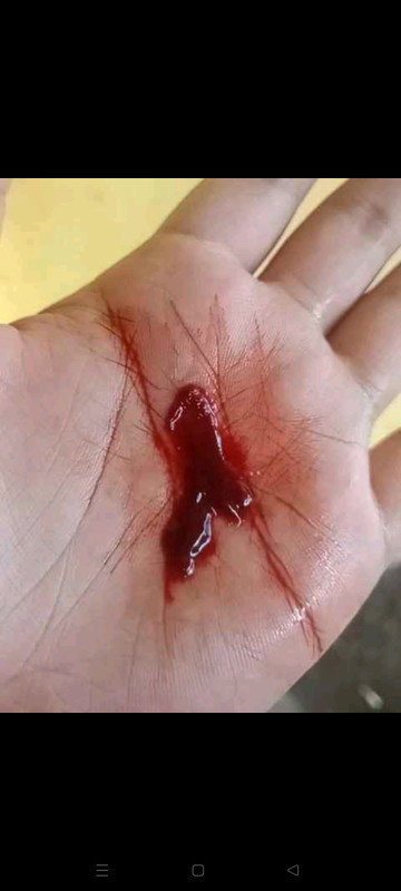 Seputar kehamilan anak pertama