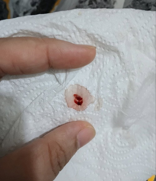 Darah implantasi atau period?
