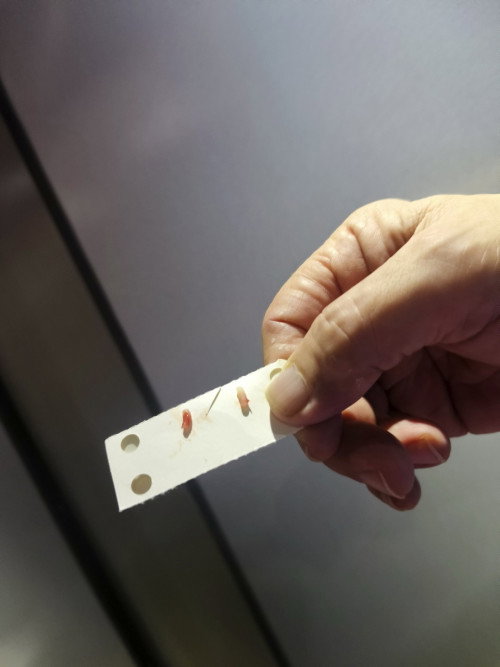 No scalpel Vasectomy