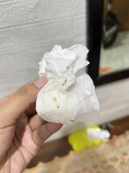 Flek atau bukan yaa?