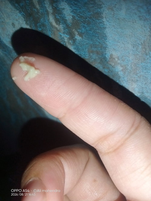 Mau tanya hamil 38 Minggu 4 hari perut bawah sakit sampe kebelakang keluar kaya gth seperti digambar