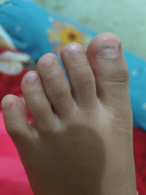 Kuku kaki pada anak