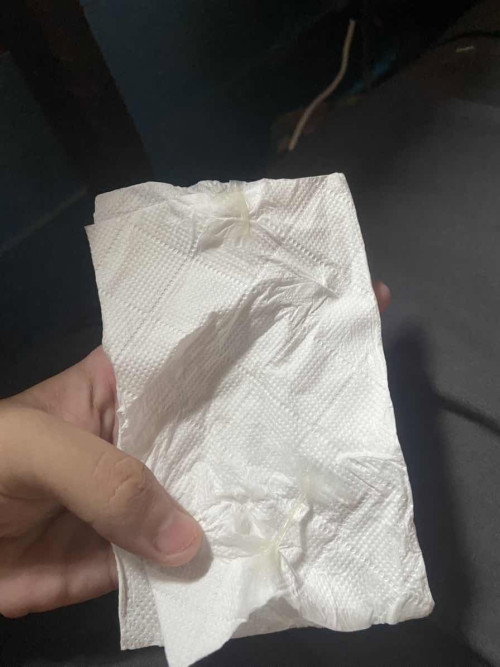 มูกออกตอนใกล้คลอด