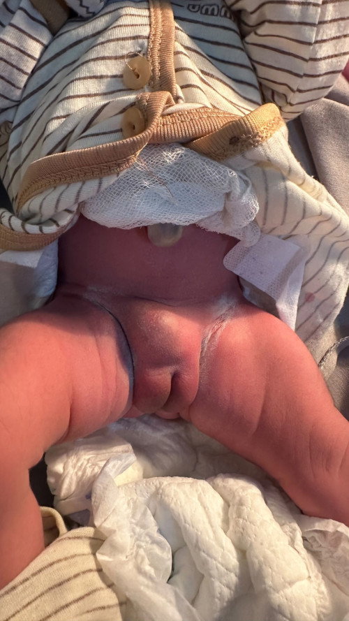 Hemangioma dalam