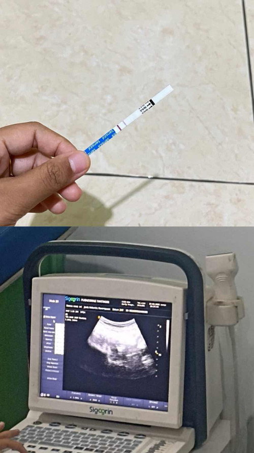 Usia kandungan