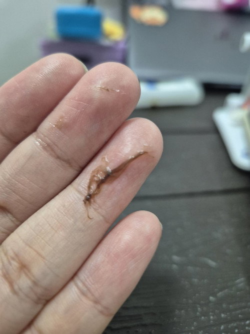 Brown Discharge at 10weeks