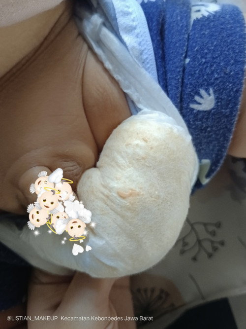 Ada bercak oren di bekas pampera, cairan kental seperti pasta keju