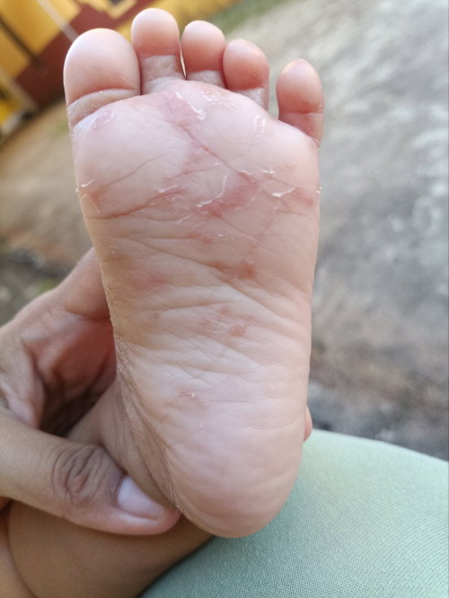 Ini alergi atau apa yah
