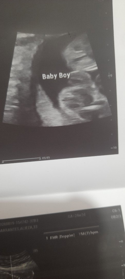 UltrAsound