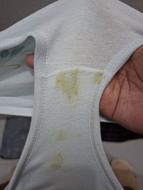 Discharge Color