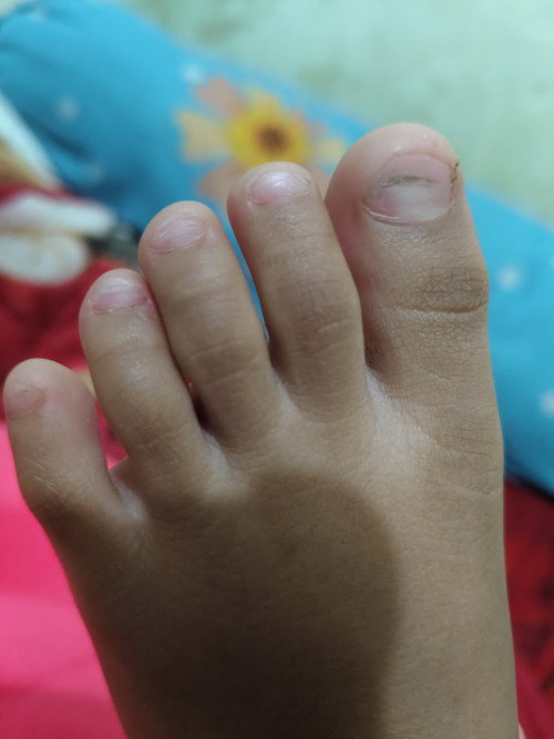 Kuku anak