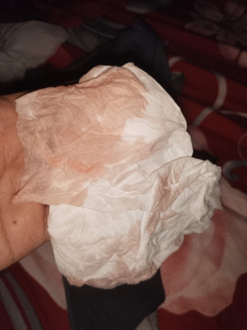 Apa ini mucus plug?