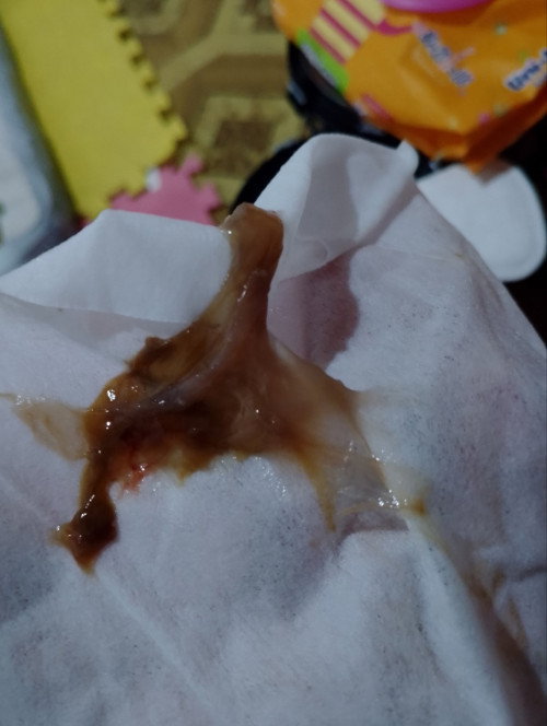 discharge ng CS mom