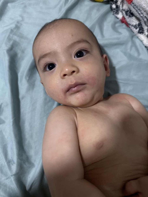 Pedia Derma around Marikina/QC